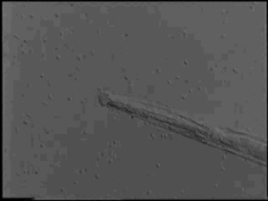 Zoospores