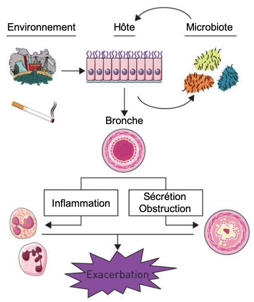 9 : Exacerbation de la BPCO